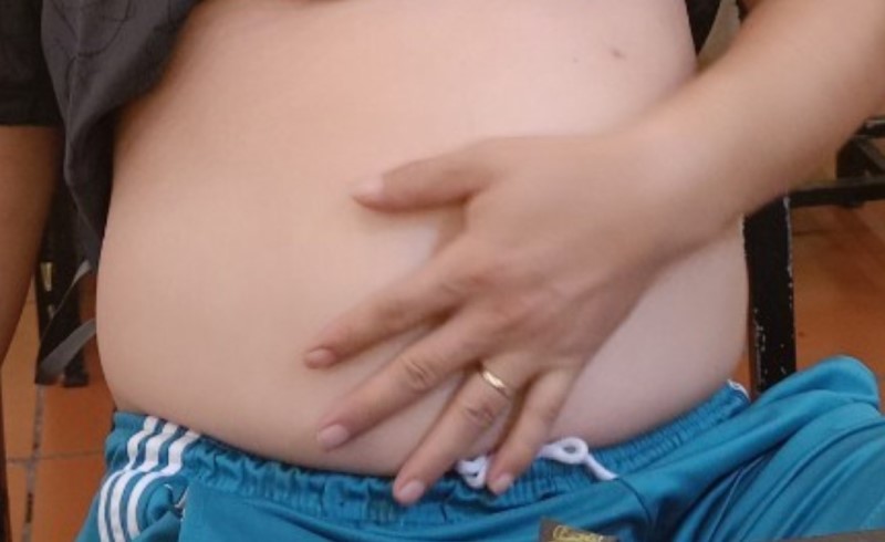 Vì sao béo phì gây chậm thai, vô sinh?